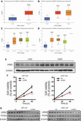 URB2 as an important marker for glioma prognosis and immunotherapy